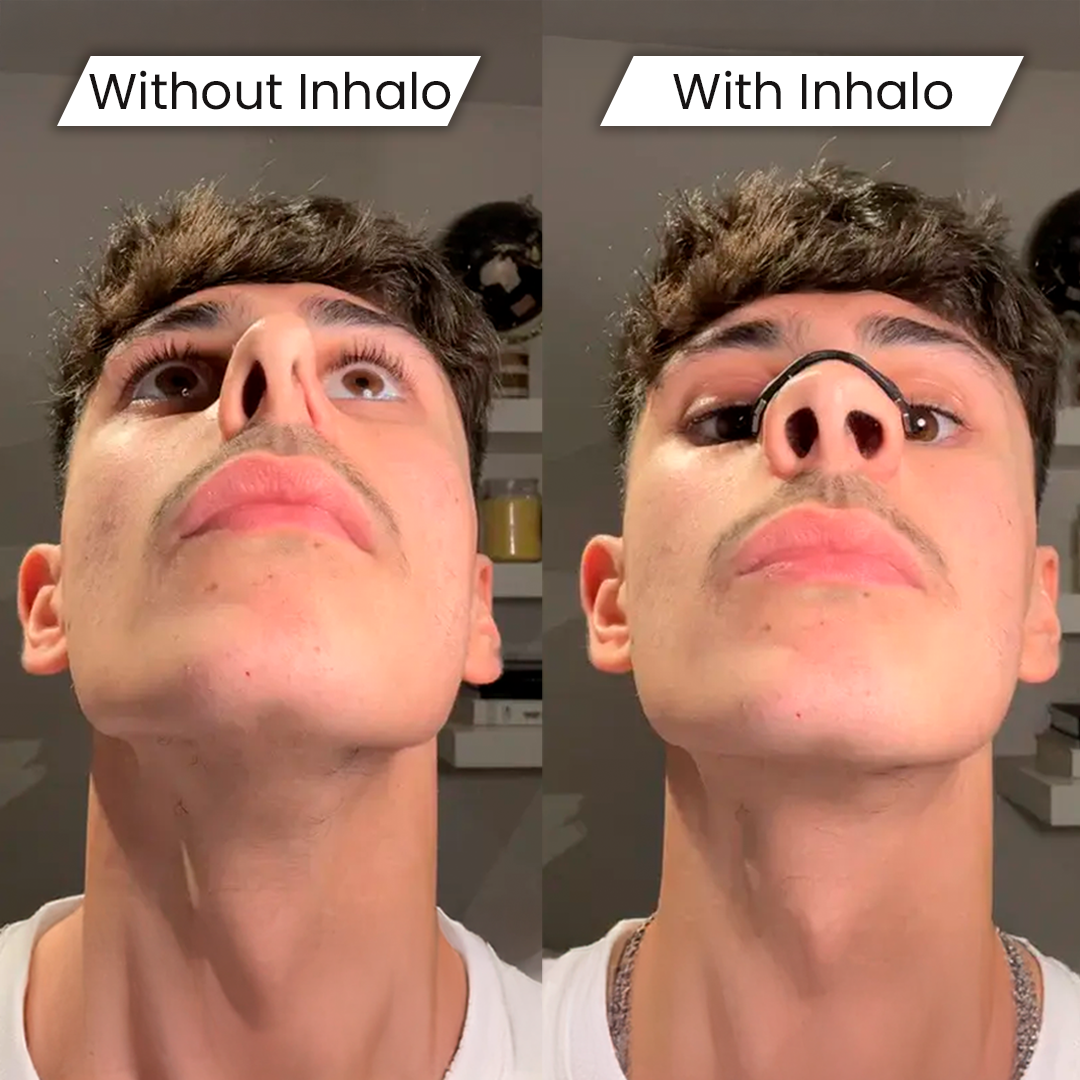 Inhalo Strip Starter Kit